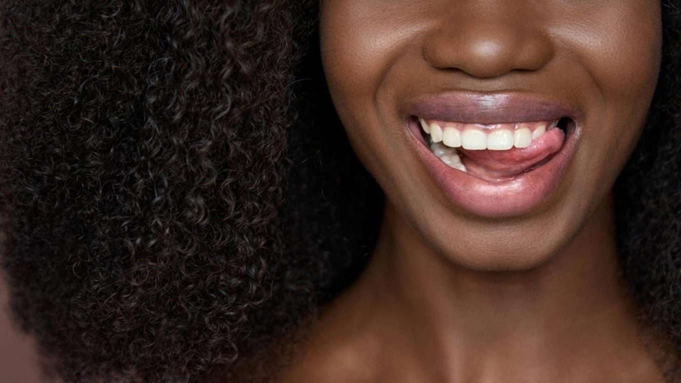 Close-up of a patient's healthy smile after a UAE dental check-up